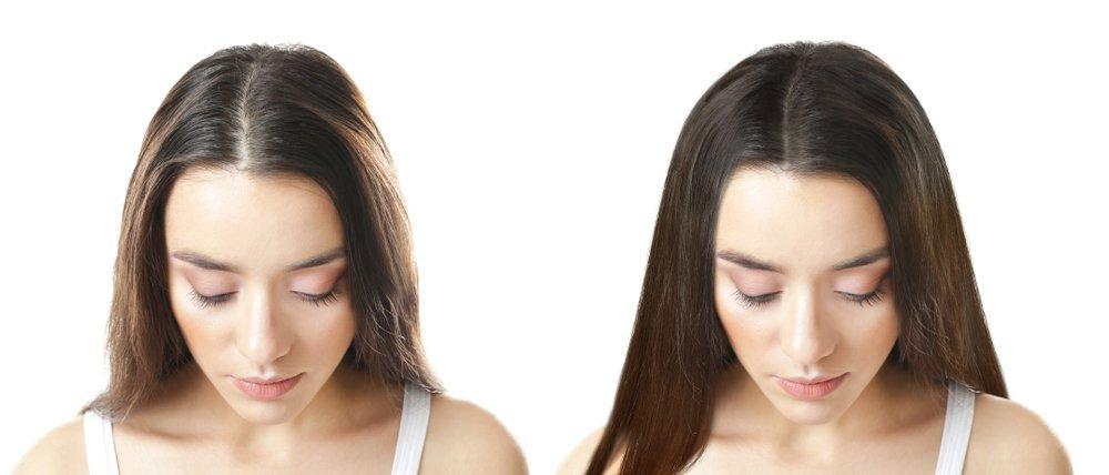 Выпадение волос после родов – как остановить? | Что делать, если стали выпадать волосы после родов?