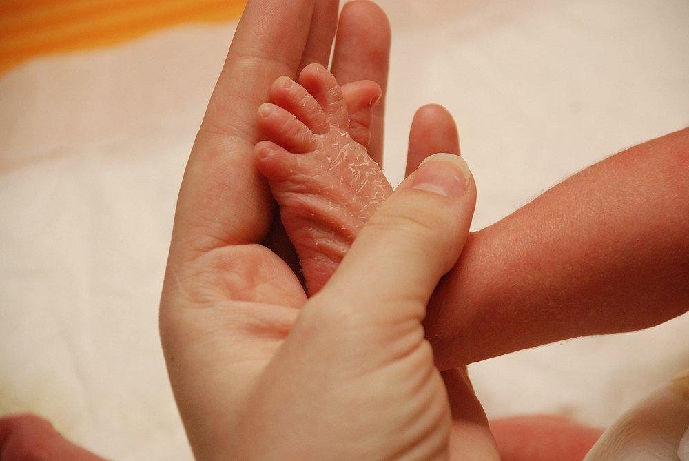 Ученые объяснили, почему у новорожденных внезапно начинает шелушится кожа || zenin-vladimir.ru