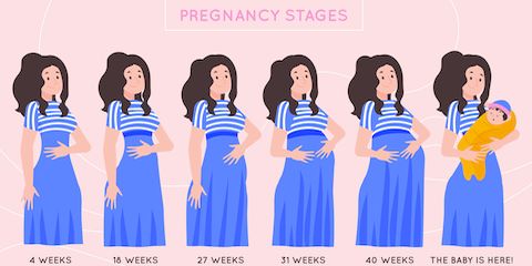 Гематома при беременности на ранних сроках