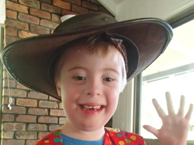 История 9-летнего австралийца с синдромом Дауна, который стал звездой "Ютьюба"