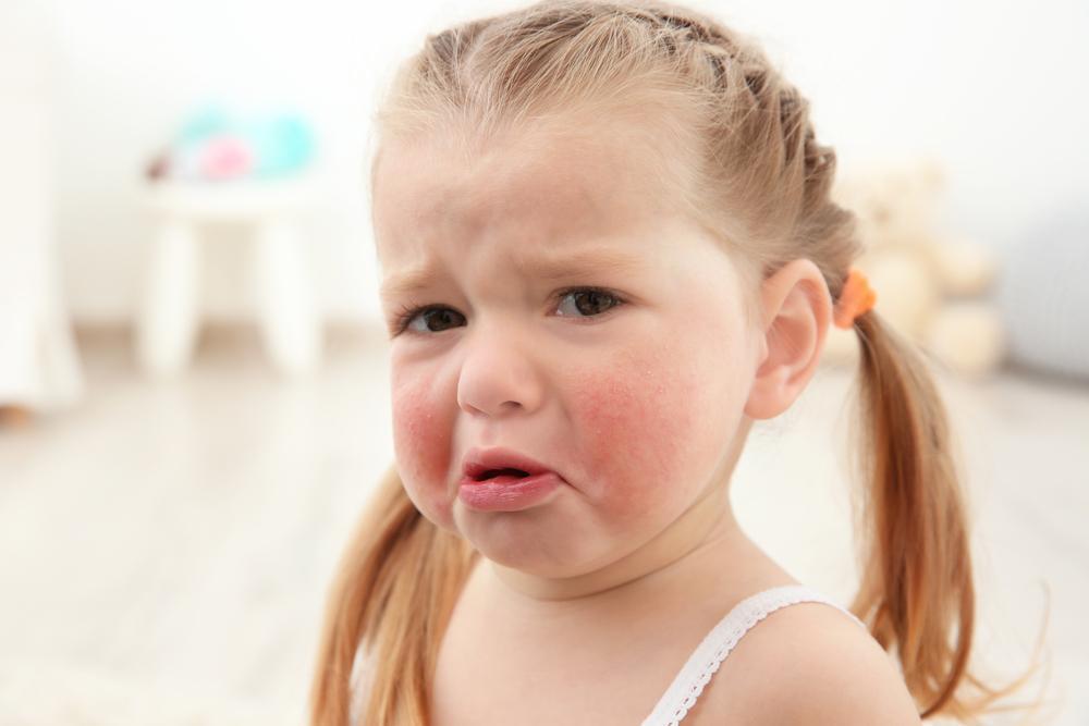 Если ваш ребёнок – аллергик