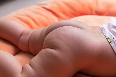 Опрелости у новорожденных: причины, лечение, профилактика